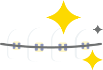 Are metal braces right for you?