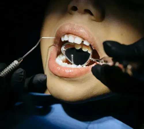 Close-up of a child’s dental checkup showing teeth examination at East End Tooth Ferry pediatric dentist in Southampton, New York.