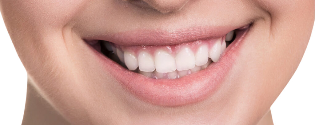 white teeth smile