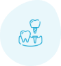 tooth implant